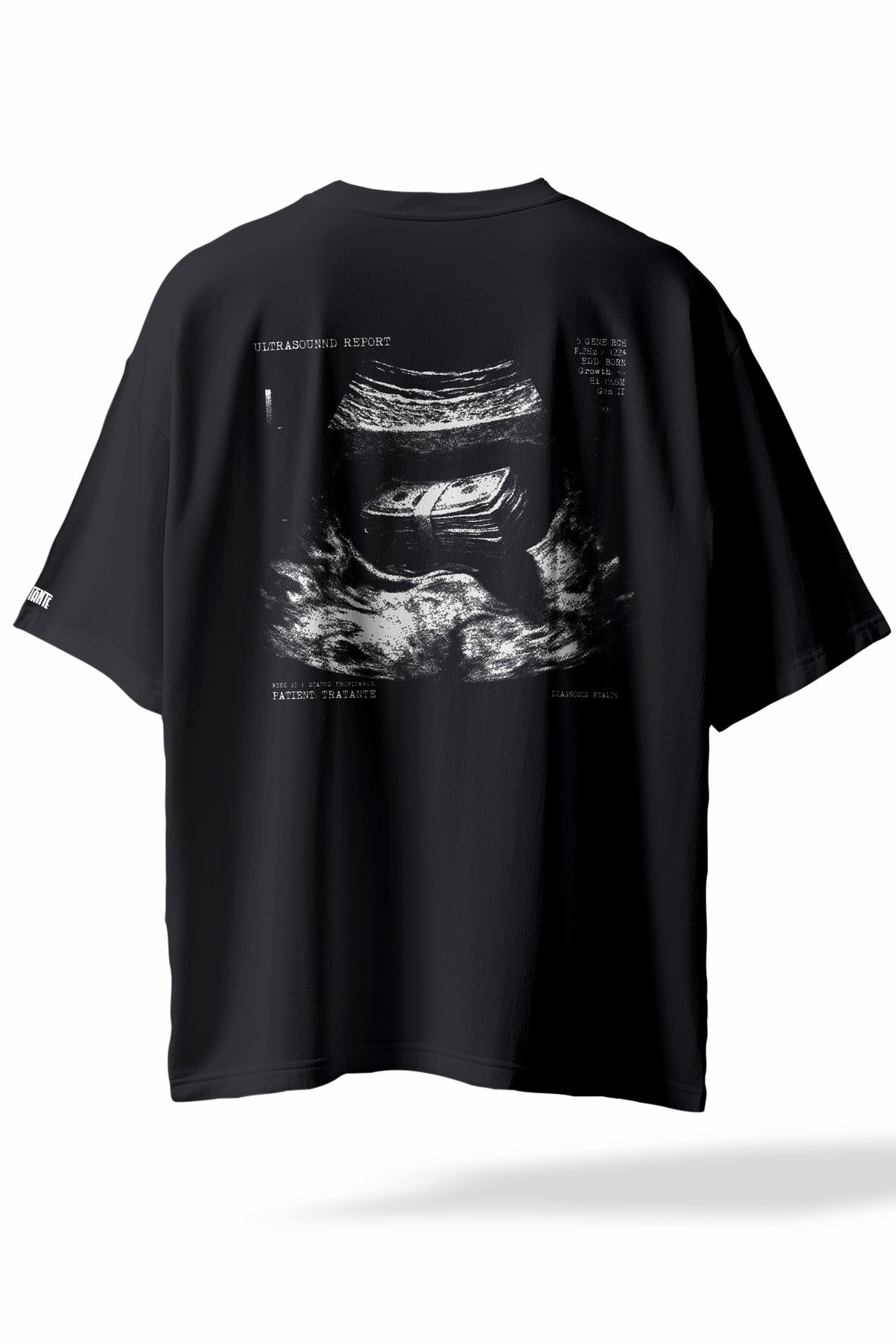 T-shirt Oversize Priorities TRATANTE®